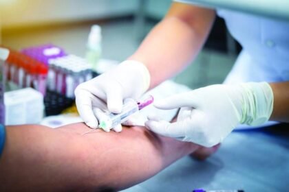 اختبار دم ثوري صورة تعبيرية