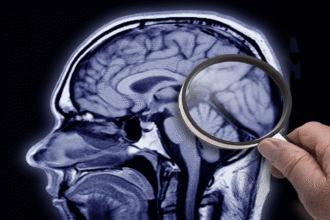 تعزيز مستويات NAD