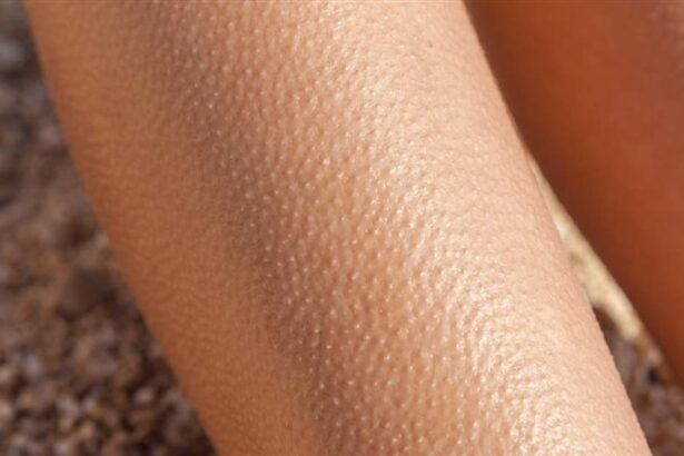 علاج جلد الوزة طبيعيًا