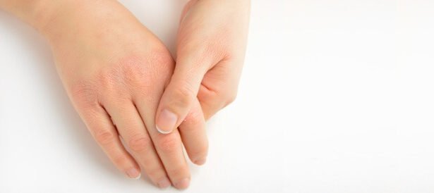 عناية اليدين في الشتاء